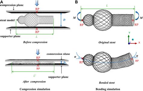 Nitinol: Biocompatibilité Exceptionnelle et Propriétés Mécaniques Adaptables pour des Applications Médicales Innovantes !